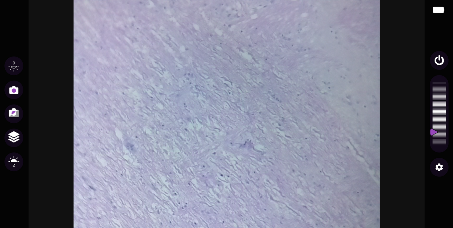 ioLight 1mm Portable Digital Microscope, XY Stage - microscopemarketplace