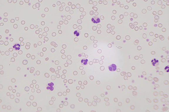 LW Scientific Microscope 60x Infinity PLAN Dry Objective | for Innovation Labscope - microscopemarketplace