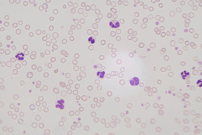 LW Scientific Microscope 60x Infinity PLAN Dry Objective | for Innovation Labscope - microscopemarketplace