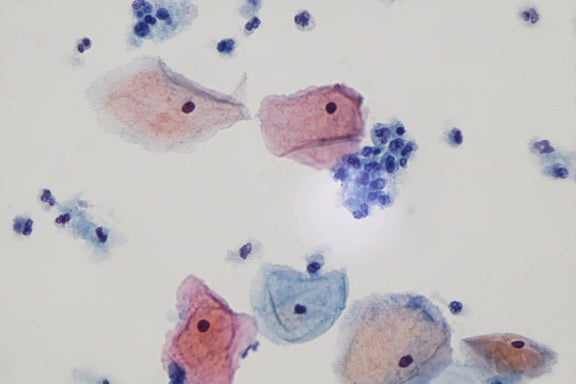 LW Scientific Microscope 60x Infinity PLAN Dry Objective | for Innovation Labscope - microscopemarketplace