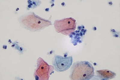 LW Scientific Microscope 60x Infinity PLAN Dry Objective | for Innovation Labscope - microscopemarketplace