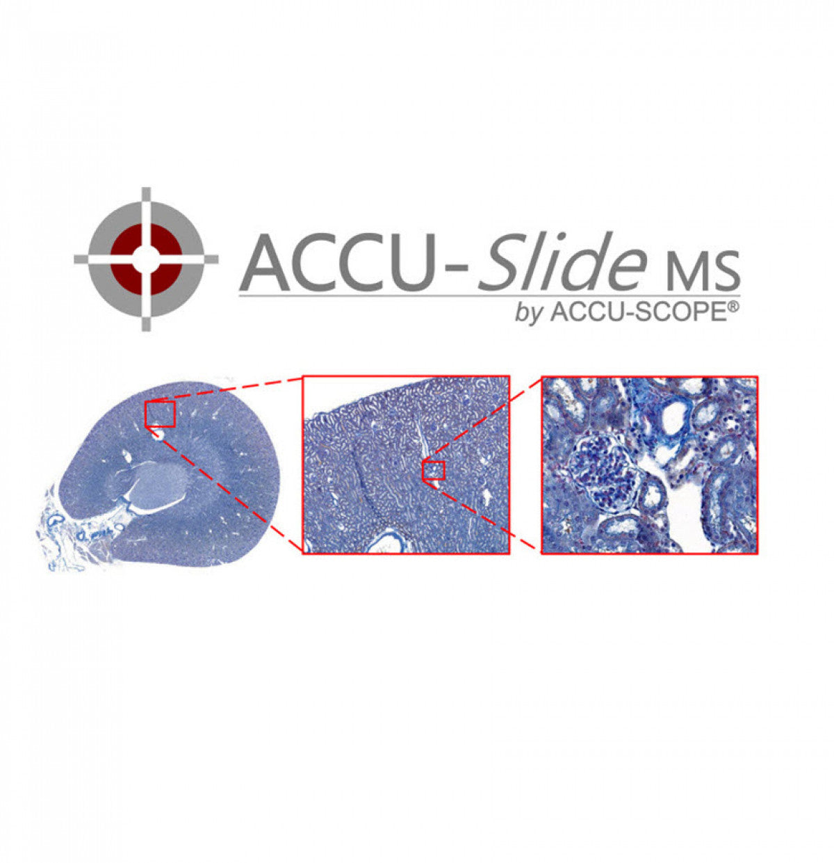 Accu-Scope ACCU-SlideMS Manual Slide Scanning System - microscopemarketplace