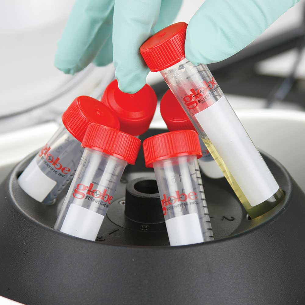 Globe Scientific Portable Clinical Centrifuge | GCC-P-12VPWR