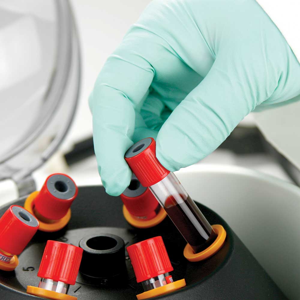 Globe Scientific Portable Clinical Centrifuge | GCC-P-12VPWR