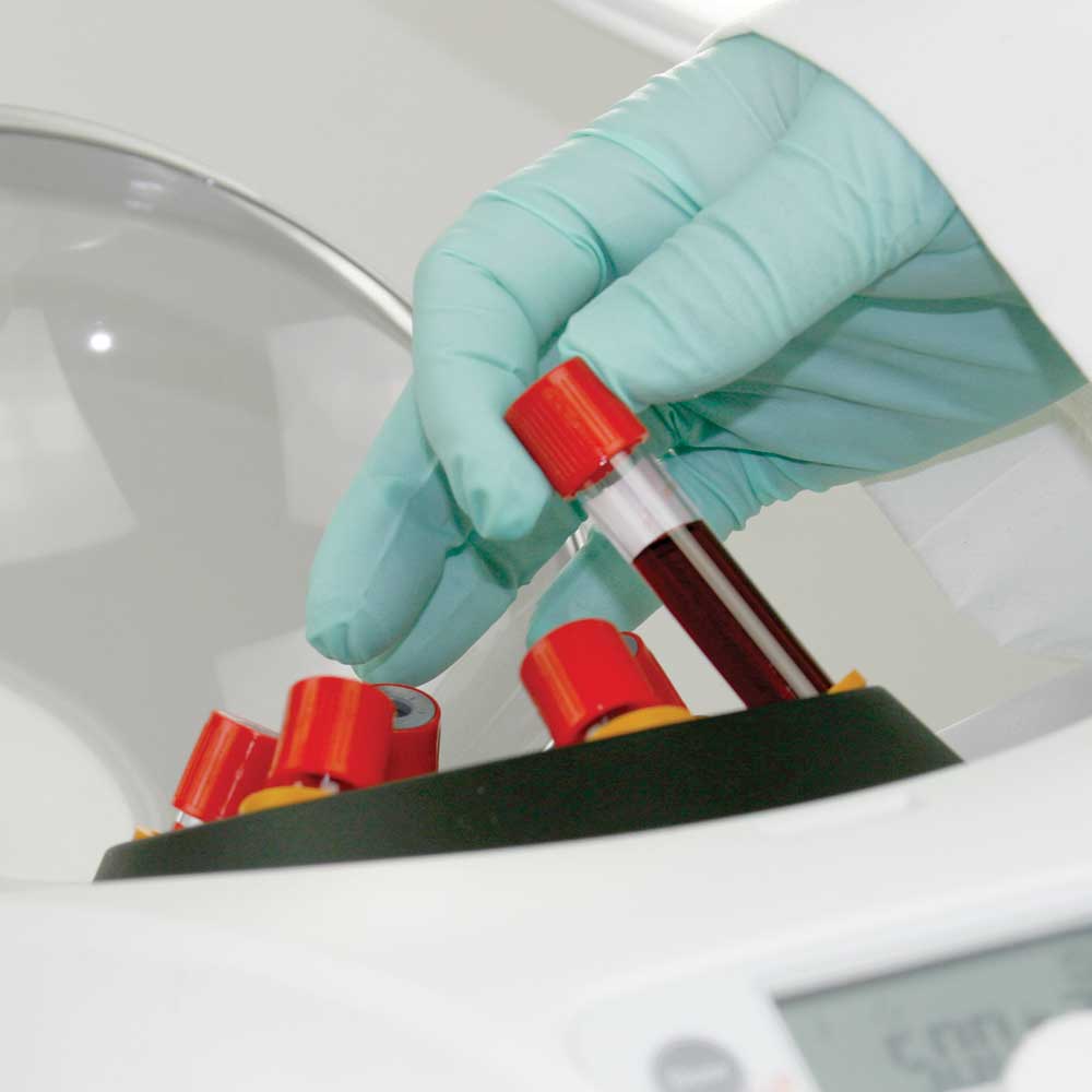 Globe Scientific Portable Clinical Centrifuge | GCC-P-12VPWR