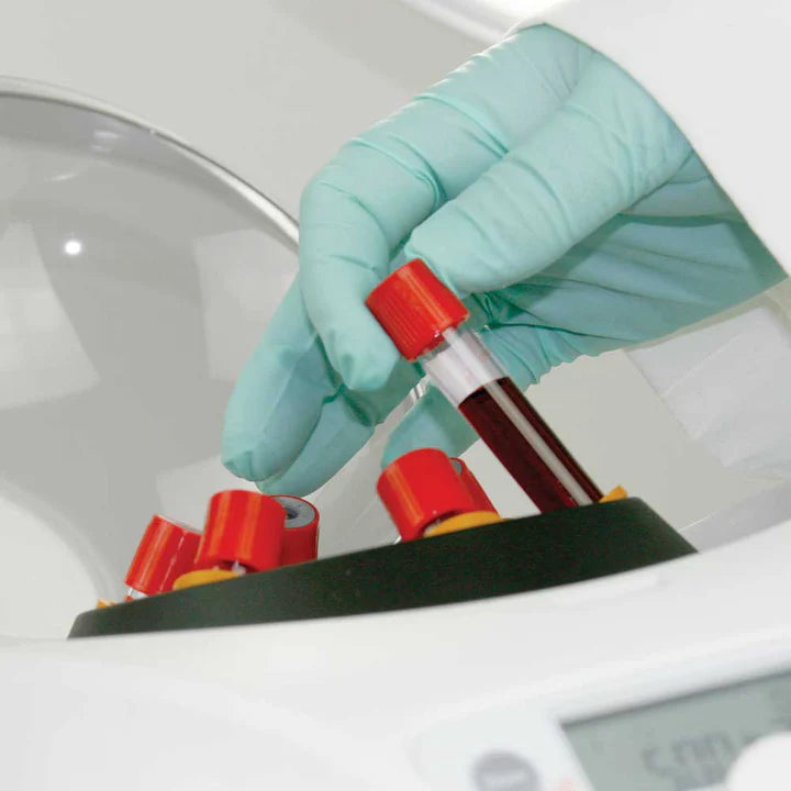 Globe Scientific Portable Clinical Centrifuge | GCC-P