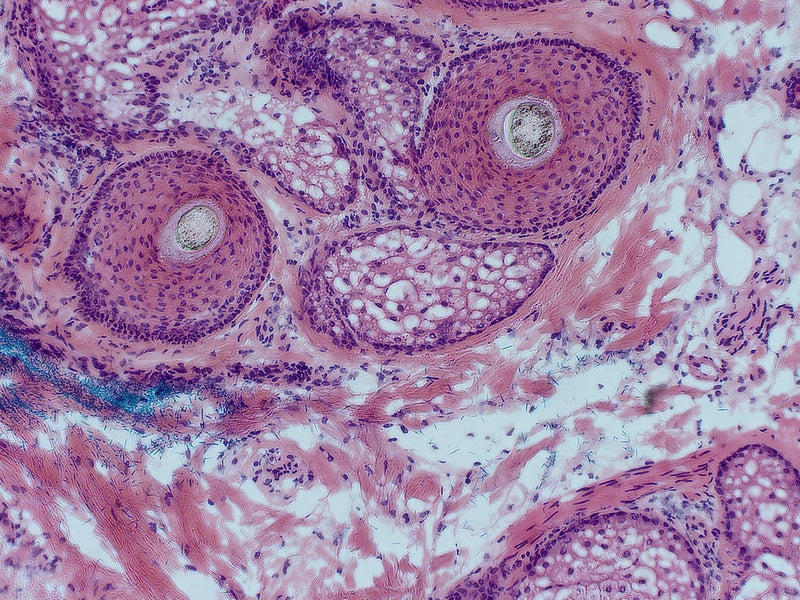 Olympus Microscope IX51 with Camera, Tilting Head & Phase Contrast | Tissue Culture - microscopemarketplace