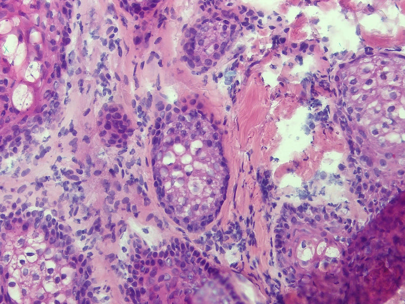 Olympus Microscope BX45 with Phase Contrast, Trinocular Head & Camera (Copy) - microscopemarketplace