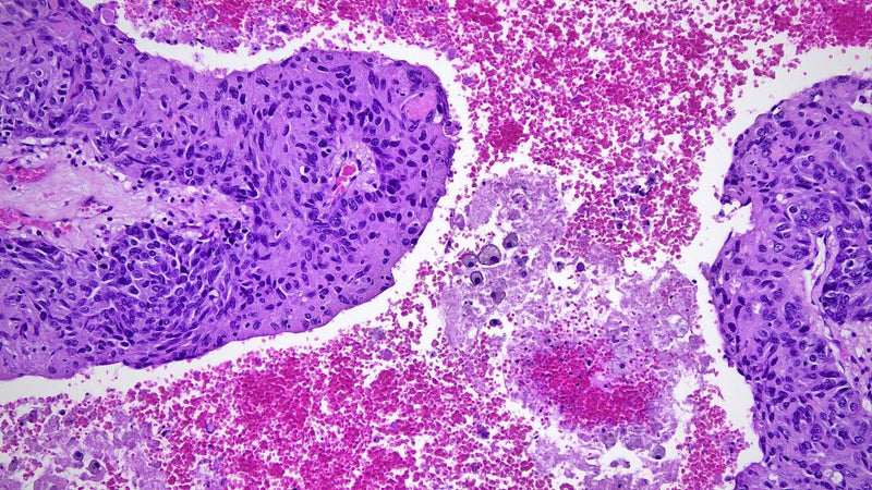 Accu-Scope ALTRA PathoPix 4K Camera | Wi-Fi - microscopemarketplace