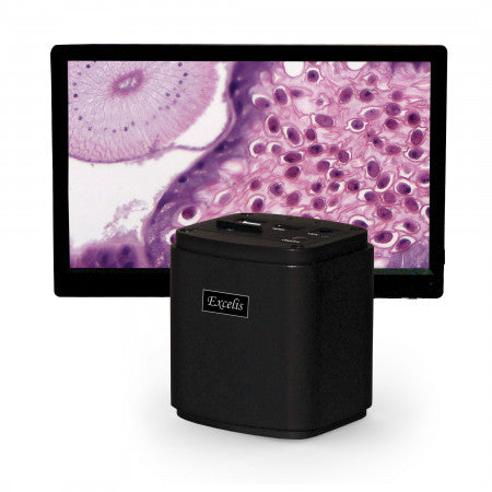 Accu-Scope Excelis™ HD Camera with HD Monitor - microscopemarketplace